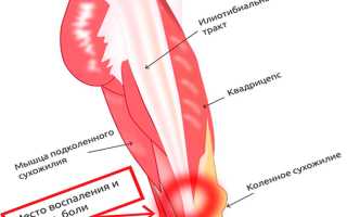 Причины жжения в коленном суставе — эффективные методы лечения