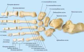 Перелом пальца на ноге