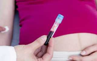 ХГЧ анализ — беременны ли Вы?