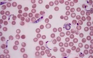 Атипичные мононуклеары в крови: норма у детей