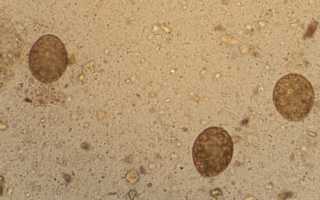 Эритроциты в кале у взрослого – норма и патология