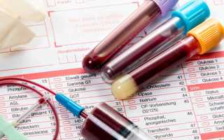 Откуда берут общий анализ крови?