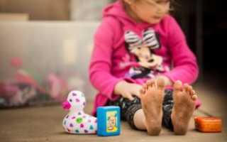 Потеют и пахнут ноги у ребенка от 2-х лет