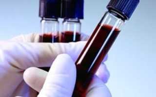 Как подготовиться к сдаче общего (клинического) анализа крови