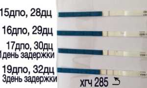 Расшифровка анализа на ХГЧ при беременности