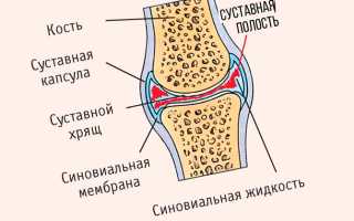 Причины хруста в позвоночнике — самые эффективные методы устранения симптома