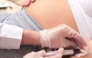 Анализ крови у беременных: норма, расшифровка
