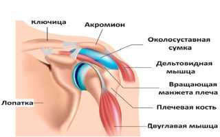 Причины появления субакромиального бурсита плечевого сустава — чем опасно заболевание