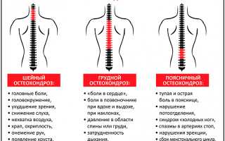 Основные причины боли в грудном отделе позвоночника — эффективные методы лечения