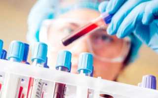 Клинический анализ крови: натощак или нет