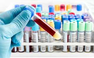 Анализ крови на биохимию: что показывает, норма и расшифровка