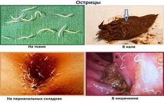 Белые червячки в кале – симптоматика, лечебная терапия