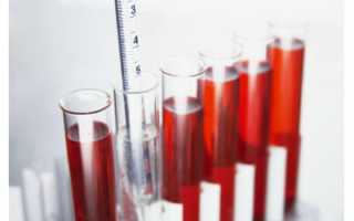 Как правильно сдать кровь на гемоглобин, натощак или нет