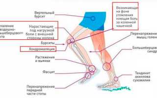 Причины боли в коленях после бега: норма или симптом серьезного заболевания