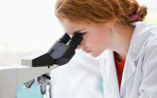 Общий анализ мочи с микроскопией осадка: нормы и отклонения