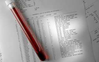 АЛаТ и АСаТ в биохимическом анализе крови: что это такое, норма, расшифровка