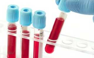 Расшифровка анализа крови с лейкоформулой у детей