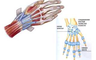 Растяжение связок кисти рук — чем грозит несвоевременное лечение болезни