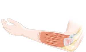 Основные причины развития тендинита локтевого сустава — основные методы лечения