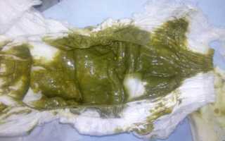 Зеленый кал у грудничка на искусственном вскармливании – когда нужно лечить