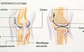 Хруст в коленях при сгибании и разгибании — лечение