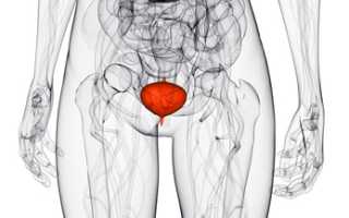 Причины, диагностика и лечение геморрагического цистита