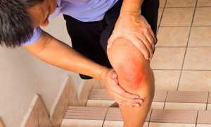 Появление боли при подъеме ноги