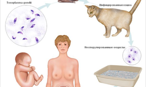 Токсоплазмоз при планировании беременности: как можно заразиться