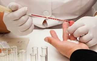 Анизоцитоз в общем анализе крови: повышен, понижен, причины