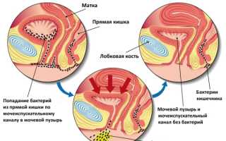 Может ли мужчина заразиться циститом от женщины?