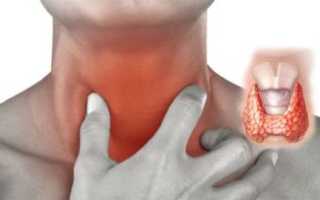 Гипергидроз, повышенная потливость и щитовидка