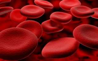 Гипохромия эритроцитов в общем анализе крови: гипохромная анемия у ребенка