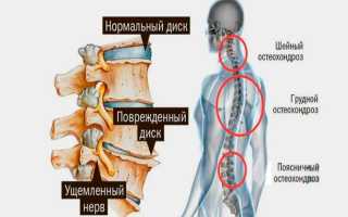 Ноющая боль в пояснице: возможные причины, диагностика и лечение