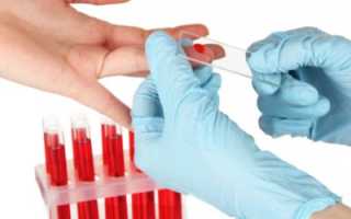 Почему могут быть повышены лейкоциты в крови у женщины, причины