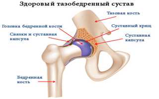 Причины вывиха тазобедренного сустава: лечение восстановления после операции