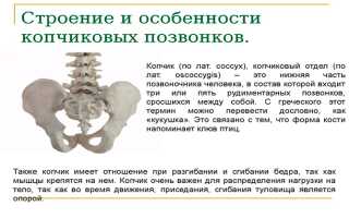 Смещение позвонков копчика — эффективные методы лечения