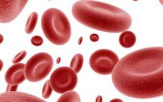 Повышенное содержание эритроцитов в крови: причины, что это означает