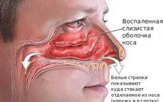 Почему закладывает нос после употребления алкоголя