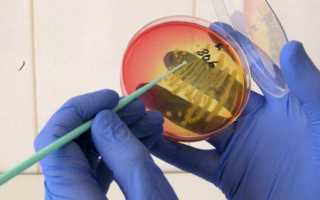 Бактериологическое исследование мочи (бак посев) на микрофлору