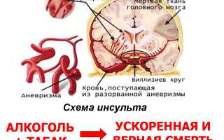 Как алкоголь влияет на инсульт?