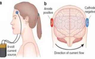 Кодирование током от алкоголизма: эффективно или нет?