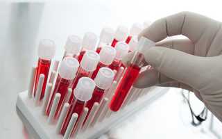 Общий (Клинический) анализ крови: расшифровка результатов и норма в таблице