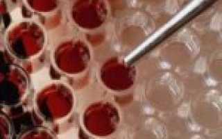 Повышение лейкоцитов в крови при беременности