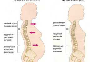Почему болит поясница