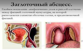 Почему болит шея с правой стороны и как избавиться от боли