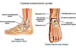 Почему болит голеностопный сустав при ходьбе и способы лечения