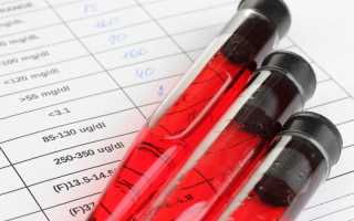 Общий (Клинический) анализ крови с лейкоцитарной формулой: что это, расшифровка