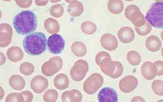 Лейкоциты в кале — диагностика и терапия