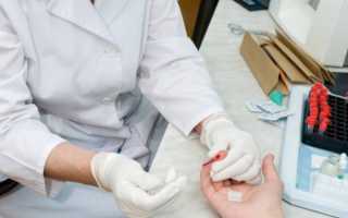 Откуда берут общий (клинический) анализ крови: из пальца или из вены
