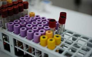 Анализ крови на биохимию: как правильно подготовиться пациенту